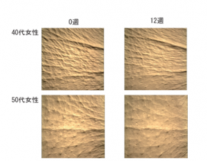 プリンセスケアで、シワが治る